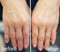 ◆ 【手元シワふっくら】ハンドエステエイジングケアコース