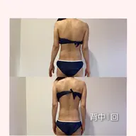 初回の方今だけお得！フォースカッター痩身60分(2部位)15,400円→5000円