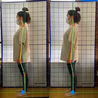 『1月限定』姿勢美人コース✌️(猫背、骨盤矯正、マッサージ)60分当院のおすすめメニュー🎶