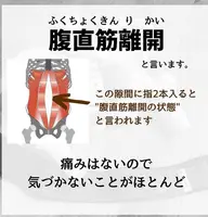 【産後ケアコース】深刻な尿もれ、腰痛、腹直筋離開の対策を深層筋にアプローチしながら癒しの施術を