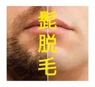 メンズ 髭 NPL方式光脱毛 お試し価格