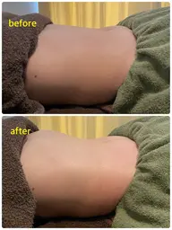 【腸内環境改善】ドライヘッドスパ60分＋腸リンパ40分 100分