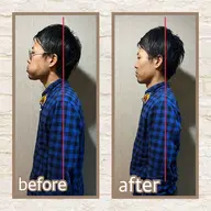 🔹頸椎矯正ストレッチ🔹肩こりからくる頭痛、目眩にお悩みの方必見！ストレートネックも改善✨