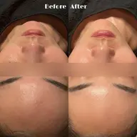 冬の乾燥撃退💫高保湿トリートメント🫧🎀