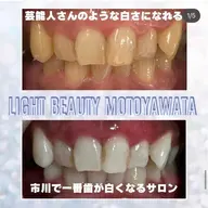✨初回限定·ナチュラルな白さ✨人間本来の自然な歯の白さを目指していきます😉✨〈10分×3回照射コース〉メンズも🆗‼️