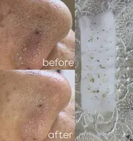 【限定9名】15分でできる毛穴矯正☆彡