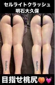 💛セルライトクラッシュ💛上半身or下半身⭐️メンズも施術可能🉑