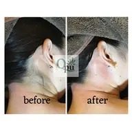 【うなじ】wax脱毛。指先まで含みます。¥3300→¥2980※男性は+¥3000