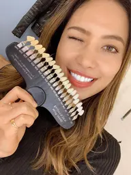 ハイパワーホワイトニング通い放題プラン🦷✨【プレミアムフリーパス※平日限定】1回20分照射