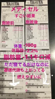(新規様限定)身体引き締めメディセル&リンパケア&耳つぼセット!