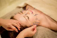 ⚡️ミニモ限定⚡️オーダーメイド美容鍼💆‍♀️通常13200円→5980円