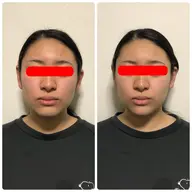 新規のお客様限定❗️小顔コース（90分）