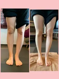 超音波エステ(フェイスorボディー)