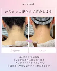 【新規女性/後ろ姿の清潔感アップ！】うなじワックス+光脱毛¥4400