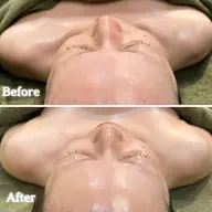 【骨格小顔フェイシャル】一回の施術でシンメトリー、小顔、リフトUP🙌顔の歪みを筋骨から捉える🧡頭、首肩しっかり🧡