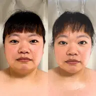 【1day🌿小顔・たるみ 】密着引き締めプログラム