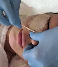 フェイシャルワックス脱毛&イオン導入(美白パック付) お顔の明るさアップ!つるすべ美肌へ✨