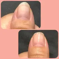 爪育〜ピンク色を伸ばす!縦長の爪へ〜