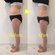 お腹痩せコース