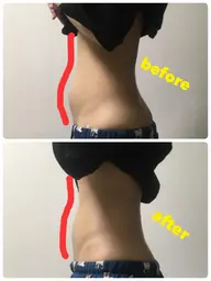 特別キャンペーン💫美容鍼30分+腸マッサージ30分の計60分💎ポッコリお腹対策🌹内からも外からもキレイに✨