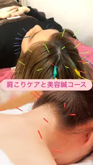首肩こり、目のお疲れケア‼️小顔美容鍼スッキリコース🧡