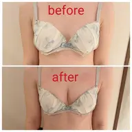 【ミニモ限定価格】大きさ・左右差・離れ乳・ハリ・下垂に◎バストアップ❤️オールハンド育乳マッサージビフォーアフターモデル