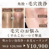 【角栓・毛穴洗浄】濃密泡パック＋水光ピーリング　¥20,900→¥10,900