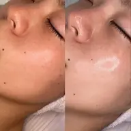 【肌悩み相談OK】どのメニューが合うか迷ったらこちら◎最適メニューをご提案!4980円~