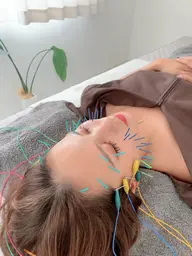 【minimo限定❤✨】ご新規様美容鍼🩷初回特別価格にて✨