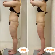 【部位別にお悩みがある方❗️】上半身or下半身×2回が¥7,700✨最新キャビラジor次世代型機器+ハンド技術‼️