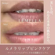 韓国シェアNo.1【ルメラ×唇💋】黒ずみ/メラニンケア¥65000→¥32900