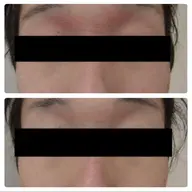 メンズ◎【乾燥・敏感肌でお悩みの方】肌診断+適切な洗顔+鎮静・保湿コース　90分