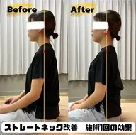 ミニモ特集 期間限定 ストレートネック改善 40分 🌸お写真掲載OKの方限定🌸