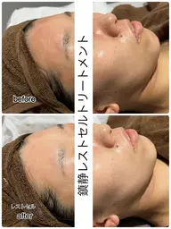 【圧倒的透明感】美肌鎮静トリートメント🐹✨14300→13000