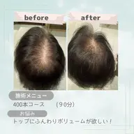 【全員OK】月イチメンテに◎定期ケア500本 通常¥22,000