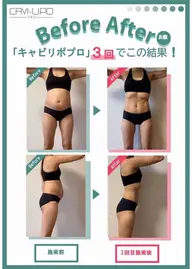 全身大幅サイズダウン【全身スリム】(キャビテーション/ラジオ波/吸引/EMS) 結果重視🔥短期で理想の身体へ
