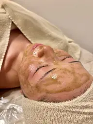 【ニキビ・赤み・毛穴】O.H.Lハーブピーリング