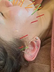耳ツボジュエリーでキレイが続く💎【耳ツボ×美容鍼】肩こり/眼精疲労/リフトアップ/ダイエット/ストレス解消