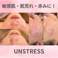 水光肌ミルクピーリング〝アンストレス〟🩵繰り返す肌荒れ・かゆみ・ごわつき・敏感肌にはこれ!ダウンタイム無し✨