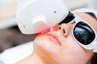 【ダイオードLED顔脱毛】光では難しい色黒肌、髭脱毛を短期完了 ※美肌効果は無し