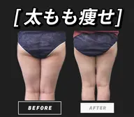 ⭐️丸っと下半身⭐️脚痩せ極🦵キャビテーション90分【ほぼマシーンかけ】