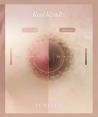 韓国で話題✨ルメラ 乳輪