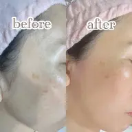 ✨絹肌ヌクレールフェイスワックス＋垢抜け眉WAX＋間引き✨鎮静パック付き