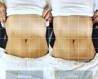 内蔵調整ウエスト痩せ