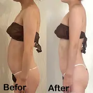 27000→18000【最新高周波カッピング】ぽっこりお腹・浮き輪肉・くびれにアプローチ！！《1部位✖️3回》