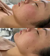 3月🌸/圧倒的に小顔！オーダーメイドフェイシャル90分/浮腫み解消・リフトアップ/デコルテ・ヘッドマッサージ込み