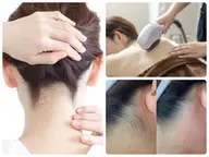 【人気部位のセット脱毛】★うなじ+首周り+背中★美肌脱毛 保湿ケア付き