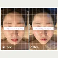 ★NO.1★＼脳疲労ケア65分／【ヘッドスパ・顔・耳・首肩・デコルテ・背中・腕】 表情筋ほぐし+上半身オイルリンパ付き♪