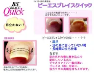 B/Sブレイスクイック1本（巻き爪の緩和）