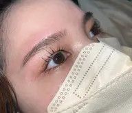 ❤️‍🔥フェイシャルワックス💆韓国美肌